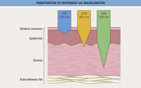 UVA and UVB Damage Chart - Susong Dermatology